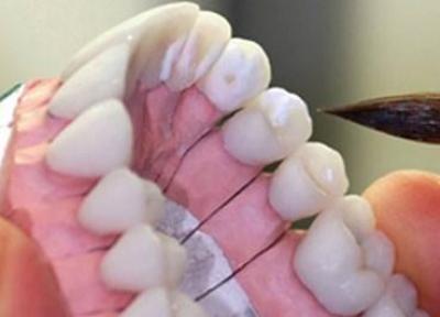 کارشکنی وزارت بهداشت در فرایند اجرای ساماندهی لابراتوار های پروتز دندانی در ایران